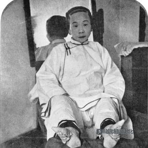 中国缠足陋习及鞋子类型